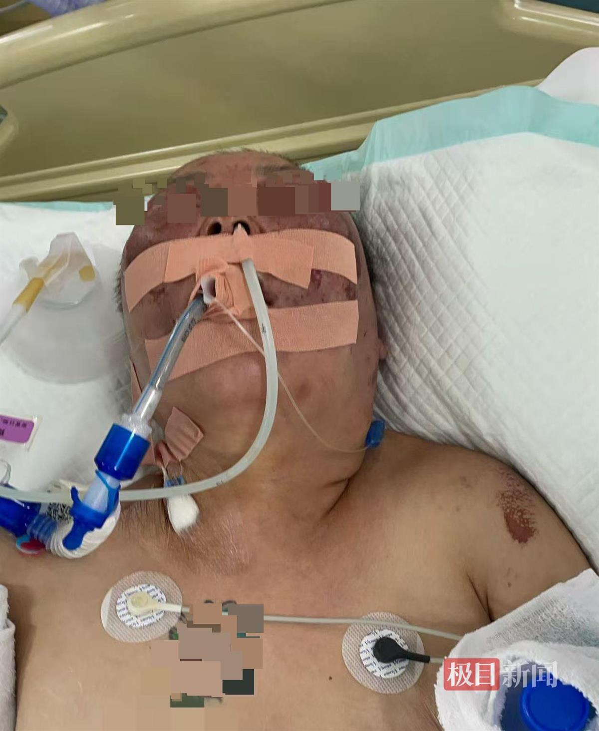 被前夫打进ICU的女子情况仍不稳定，其8岁女儿也曾遭父亲扇脸，律师：已构成故意伤害罪，或同时涉虐待罪